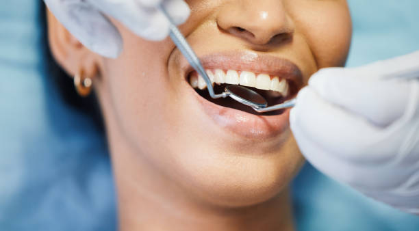 Best Emergency Broken Tooth Repair in Port St John, FL